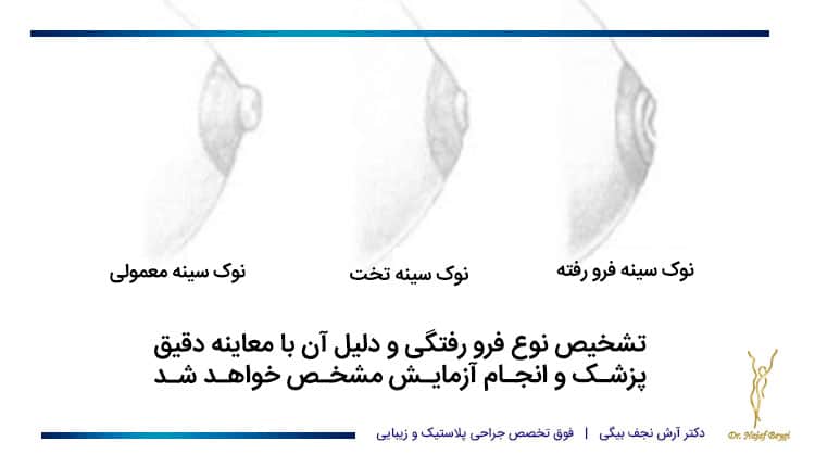 تشخیص نوع فرورفتگی سینه و درمان آن