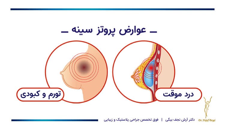 عوارض پروتز سینه