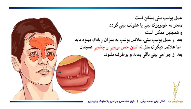 عوارض عمل پولیپ بینی