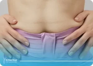 چرا ورم بعد لیپوماتیک ممکن است یک تا دو هفته باقی بماند؟