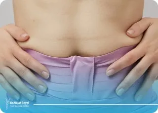 علت اب اوردن شکم بعد از لیپوماتیک و روش های جلوگیری از آن