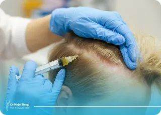 آشنایی با یکی از جدیدترین روش های کاشت مو در ایران به نام میکروفیت Micro FIT