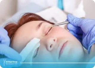 مراقبت های قبل از جراحی بلفاروپلاستی