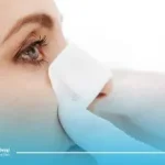 عمل بینی بعد از شکستگی