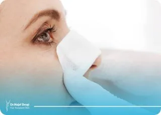 عمل بینی بعد از شکستگی برای از بین بردن فرم بد بینی