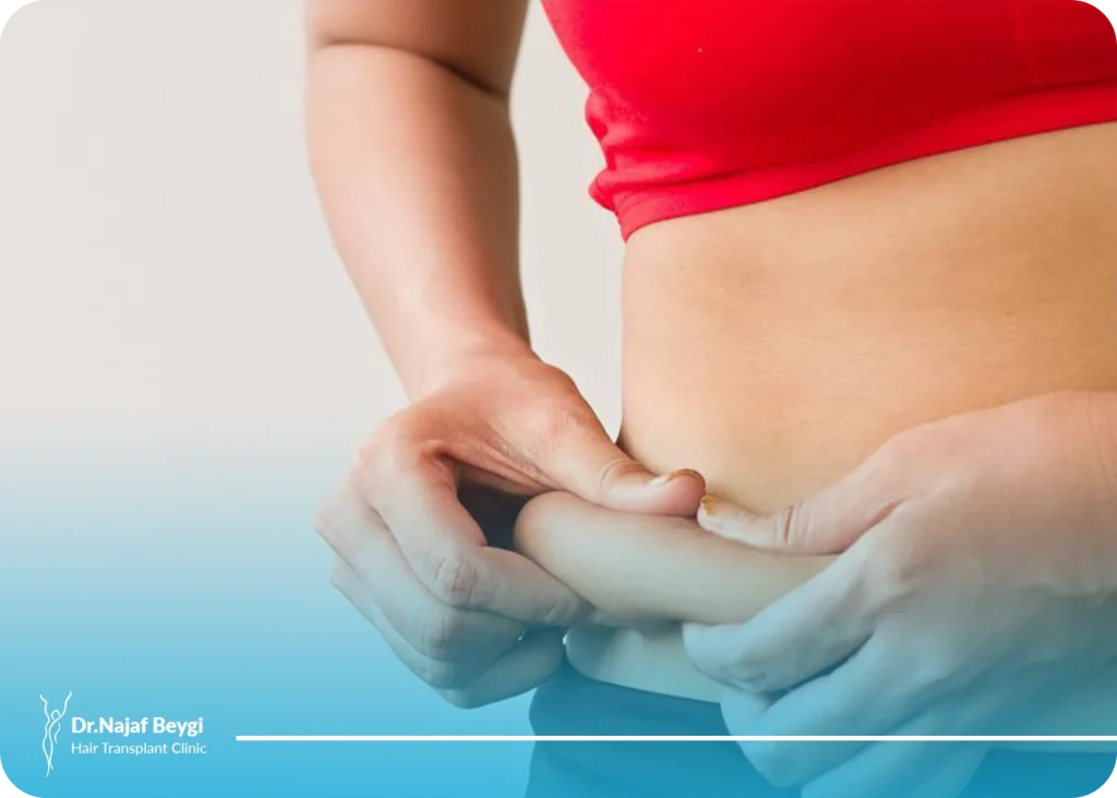 کشیدن پوست شکم | لیفت شکم بدون جراحی و عوارض آن