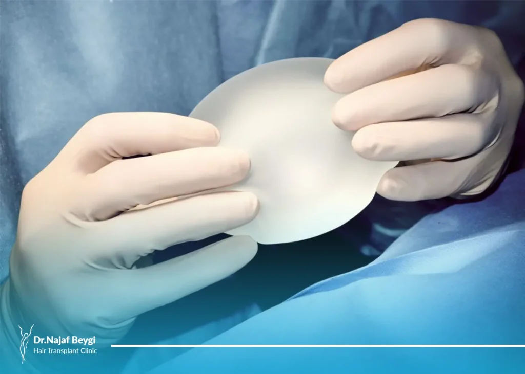 كپسول پروتز سينه و روش های درمان برای بهبود انقباض کپسول پروتز سینه