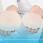 محل قرار گیری پروتز سینه