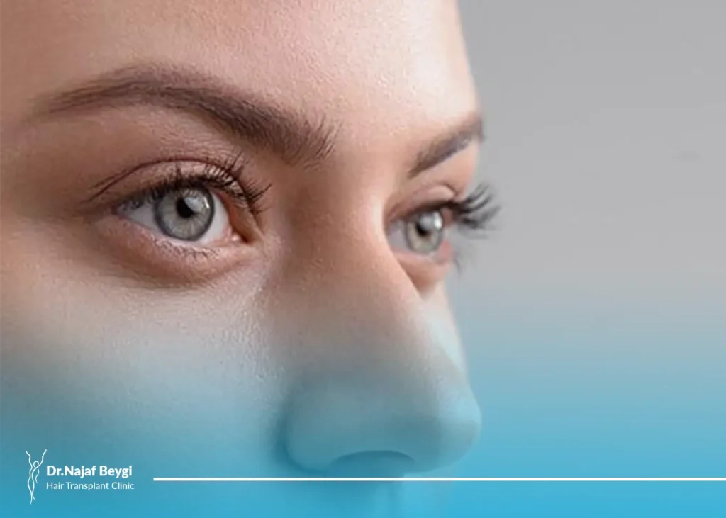 علل ورم بعد از عمل بینی و روش های پیشگیری و درمان آن