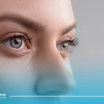 علل ورم بعد از عمل بینی