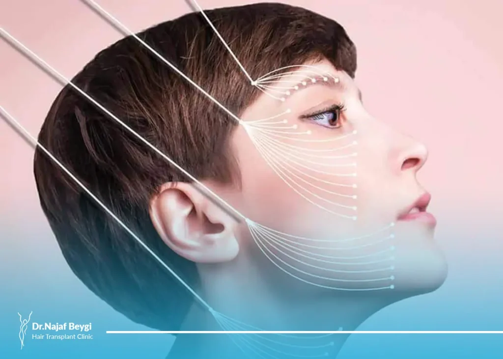 لیفت صورت با نخ چقدر ماندگاری دارد؟