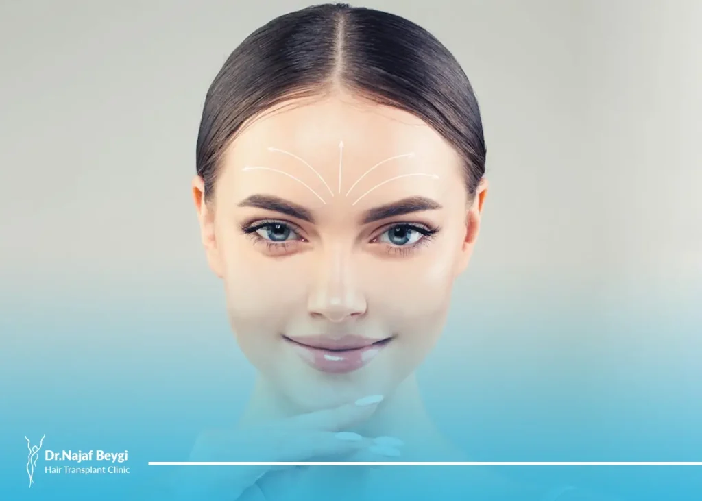 لیفت صورت با اندوتاین و نکات مهمی که در مورد آن باید بدانید