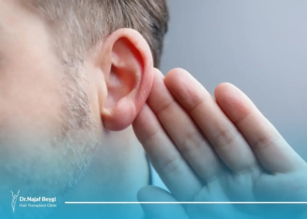 هماتوم لاله گوش | درمان گوش گل کلمی
