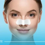 نحوه چسب زدن بینی بعد از عمل