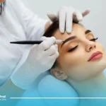 میکروبلیدینگ ابرو