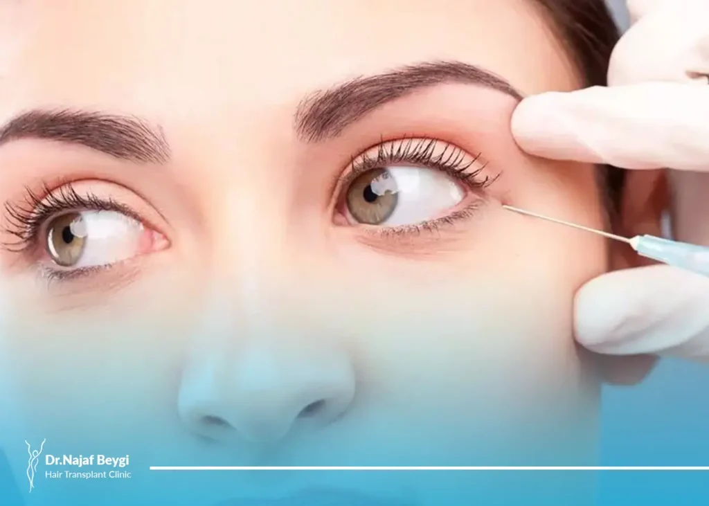 همه چیز درباره تزریق چربی به پشت پلک و موارد منع آن