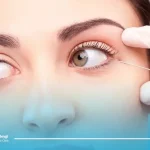 تزریق چربی به پشت پلک