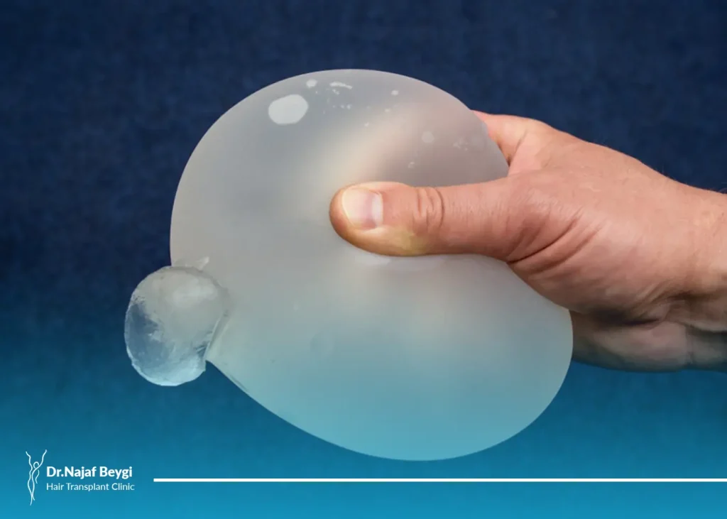 علائم پارگي پروتز سينه و روش‌های درمان آن