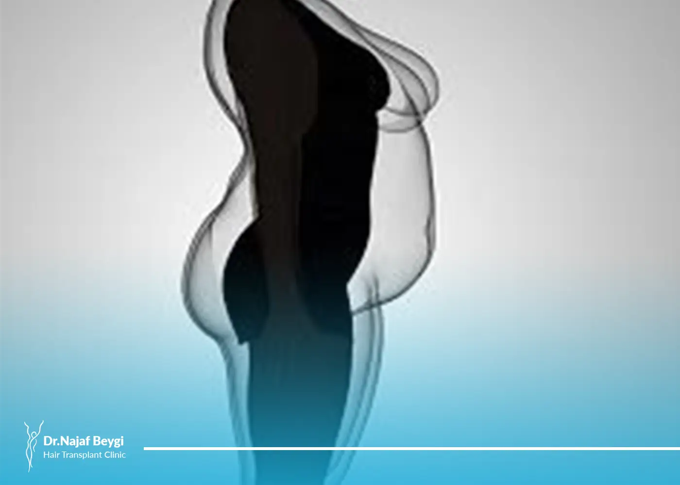عمل ابدومینوپلاستی