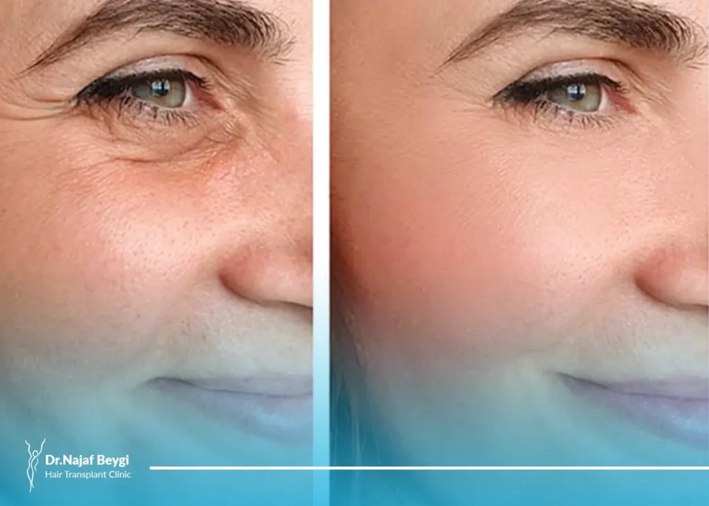 بهترین جراح لیفت صورت در تهران را با چند ویژگی مهم بشناسیم