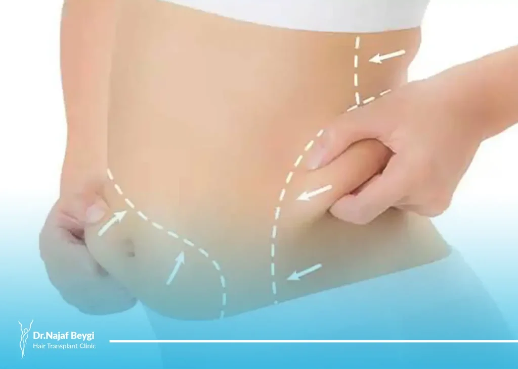 آنچه را که درباره عوارض لیپوماتیک باید بدانید!