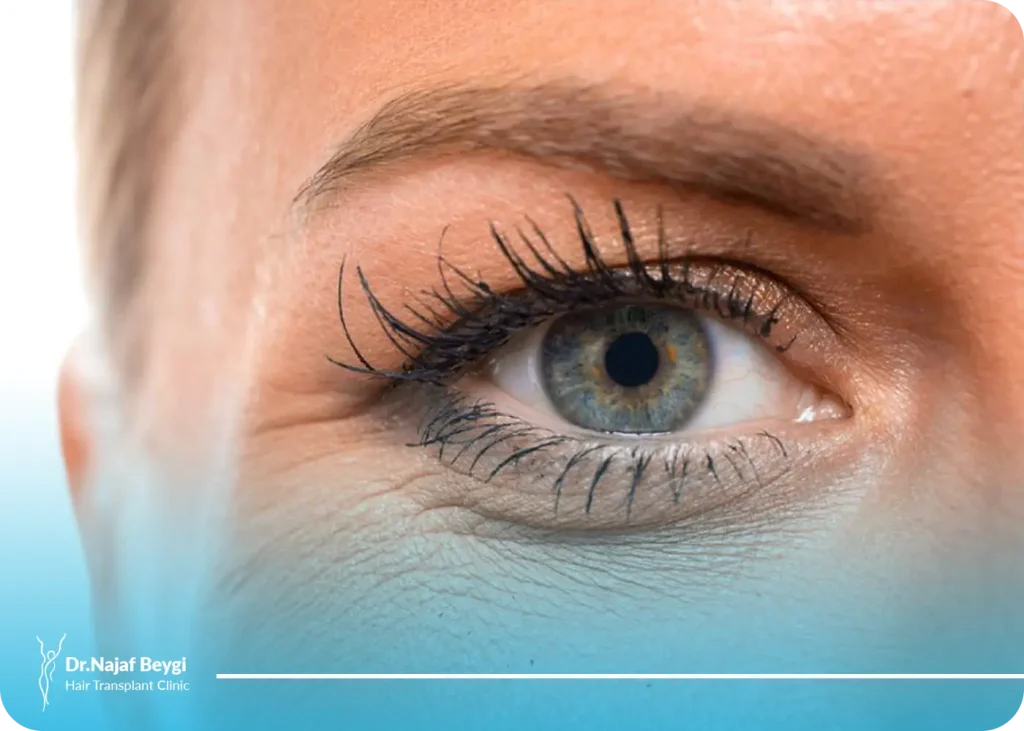 بررسی کامل بارزترین تفاوت کانتوپلاستی و بلفاروپلاستی