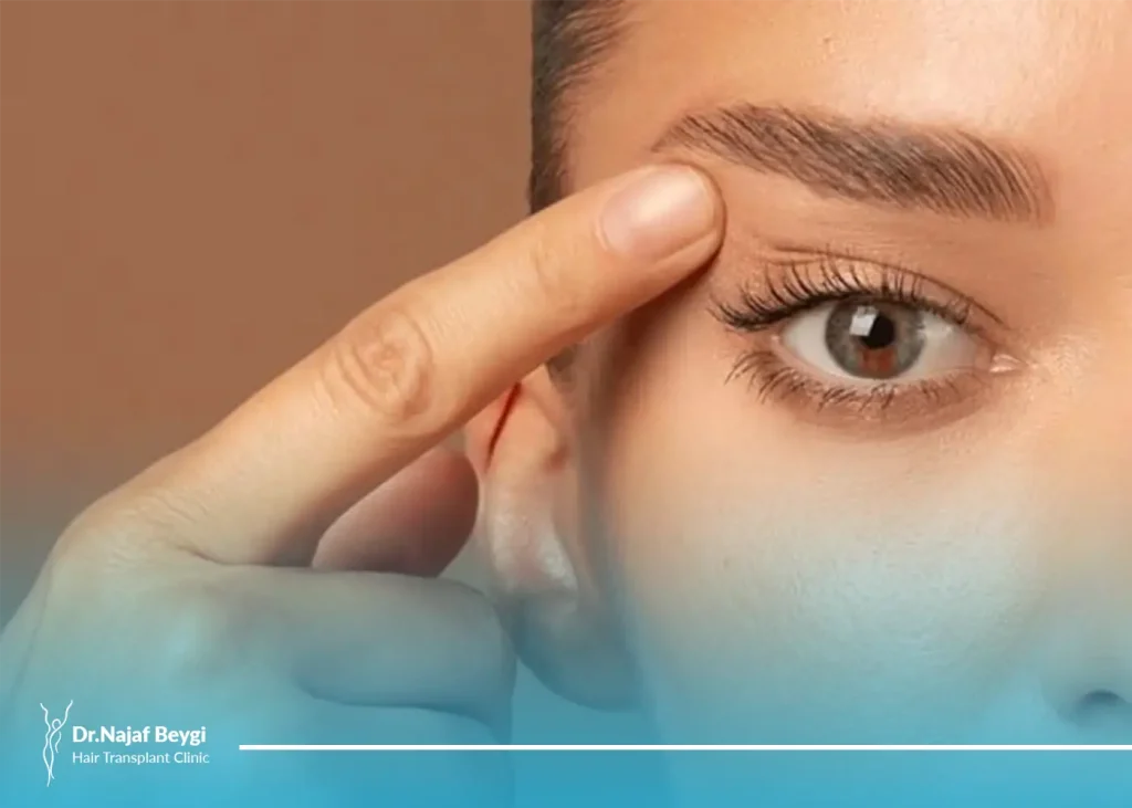 آیا عمل پلک چشم یا بلفاروپلاستی نتایج دائمی دارد؟