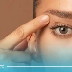 بلفاروپلاستی نتایج دائمی دارد