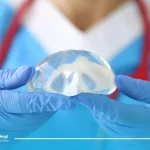 فعالیت بعد از پروتز سینه