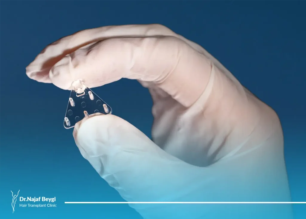 لیفت ابرو با اندوتاین چقدر موثر است و چند سال ماندگاری دارد؟