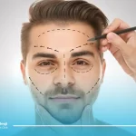 جراحی ترمیم صورت