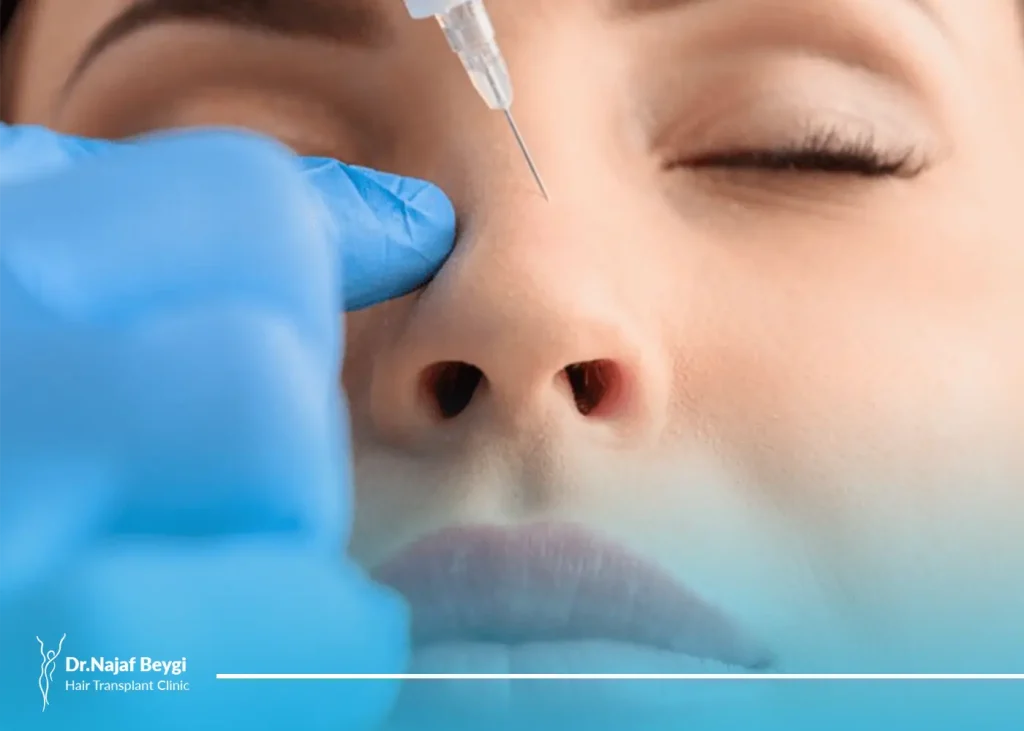 تزریق ژل به بینی برای فرم دهی بینی بدون جراحی
