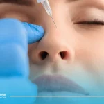 تزریق ژل برای فرم دهی بینی