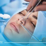 مراحل انجام عمل بینی