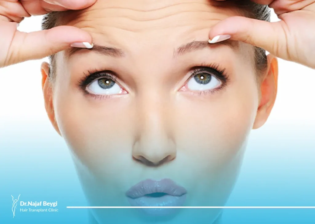 رفع چین و چروک پیشانی