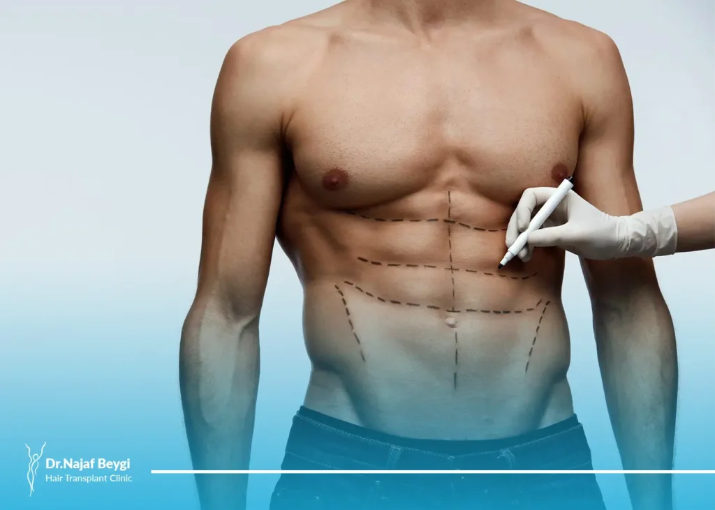 عمل سیکس پک چیست؟ سیکس پک با عمل جراحی ممکن است؟