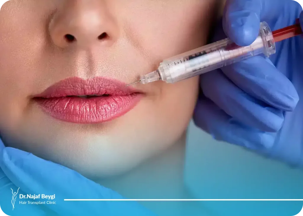 تزریق ژل لب مدل روسی + ماندگاری و عوارض آن