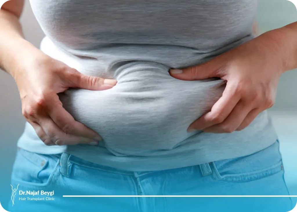 علت سفت شدن شکم بعد از لیپوماتیک چیست؟ به همراه راهکارهای کاربردی
