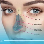 بهترین سن برای انجام عمل بینی