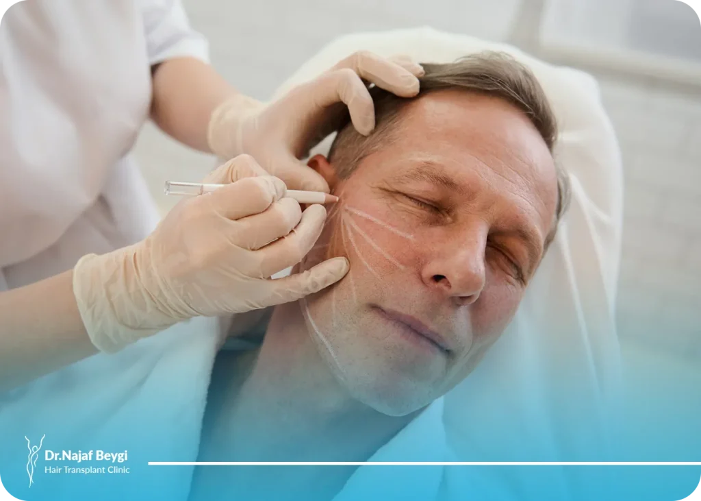 موثرترین و بهترین نوع نخ برای لیفت صورت چیست؟