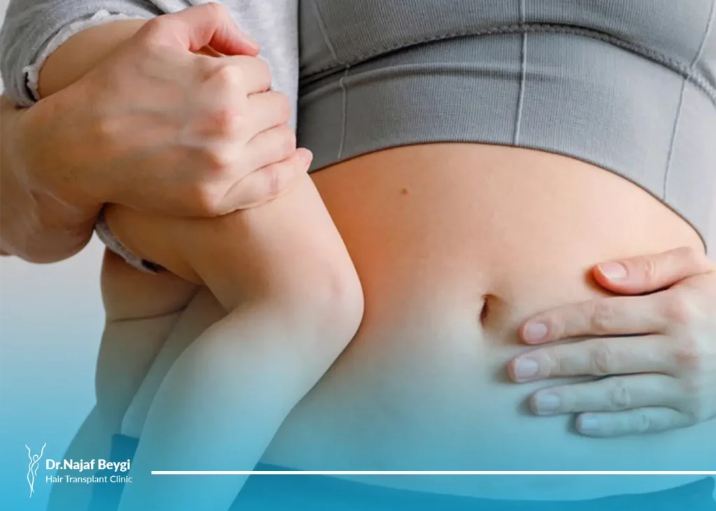 آیا ابدو همزمان با سزارین ممکن است؟