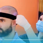 کلاه مناسب بعد از کاشت مو