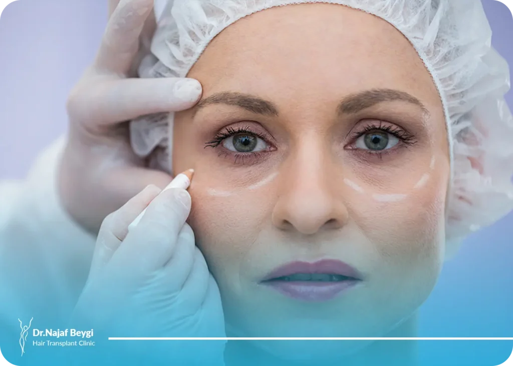 سن ایده آل برای عمل بلفاروپلاستی چه سنی است؟