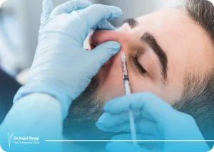 هزینه عمل قوز بینی در سال ۱۴۰۳ | راهنمای کامل جراحی بینی
