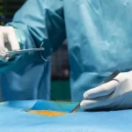 جای بخیه ابدومینوپلاستی: روش های رفع آن چیست؟