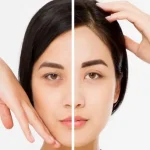 فعالیت روزانه بعد از لیفت ابرو