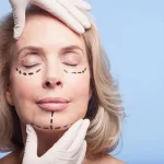 مقایسه لیفت صورت جراحی و غیر جراحی: کدام بهتر است؟