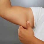 آیا لیپوماتیک باعث شل شدن پوست می شود؟