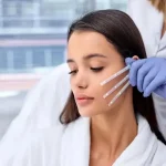 لیفت شقیقه با نخ: چگونه انجام می‌شود؟