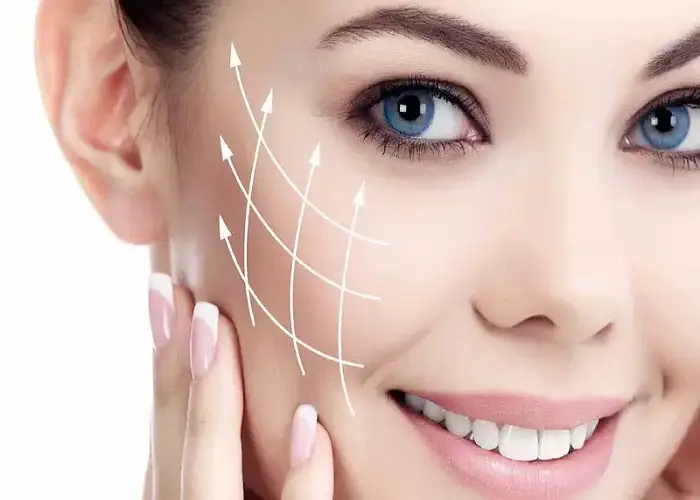 لیفت شقیقه با نخ
